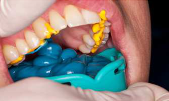 Honigum Pro Putty Soft фото 1