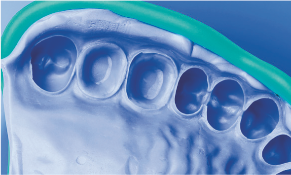 Silagum Putty Standard DMG фото 1