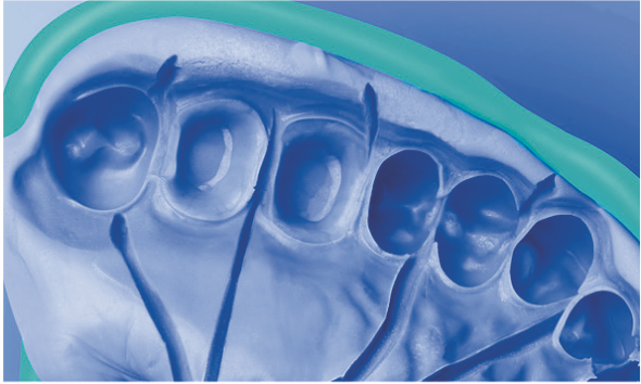 Silagum Putty Standard DMG фото 2