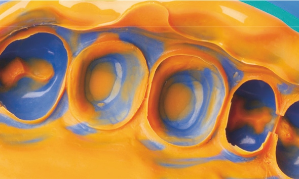 Silagum Putty Standard DMG фото 3