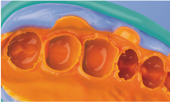Silagum Putty Standard DMG фото 4